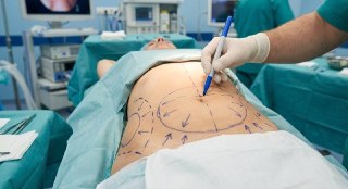 Женщина умерла после неудачной липосакции в Ульяновске